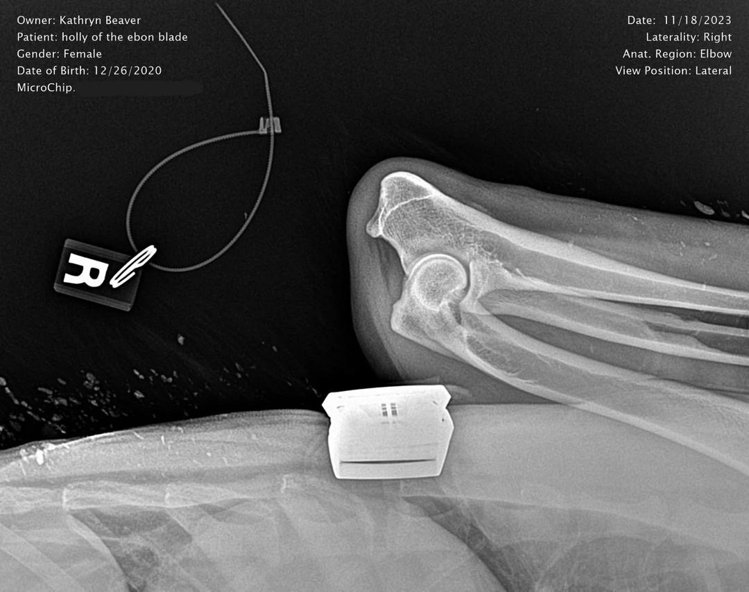 Holly Right Elbow X-Ray